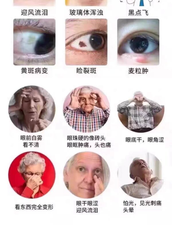 XiongDan Lutein eye drop symptom2